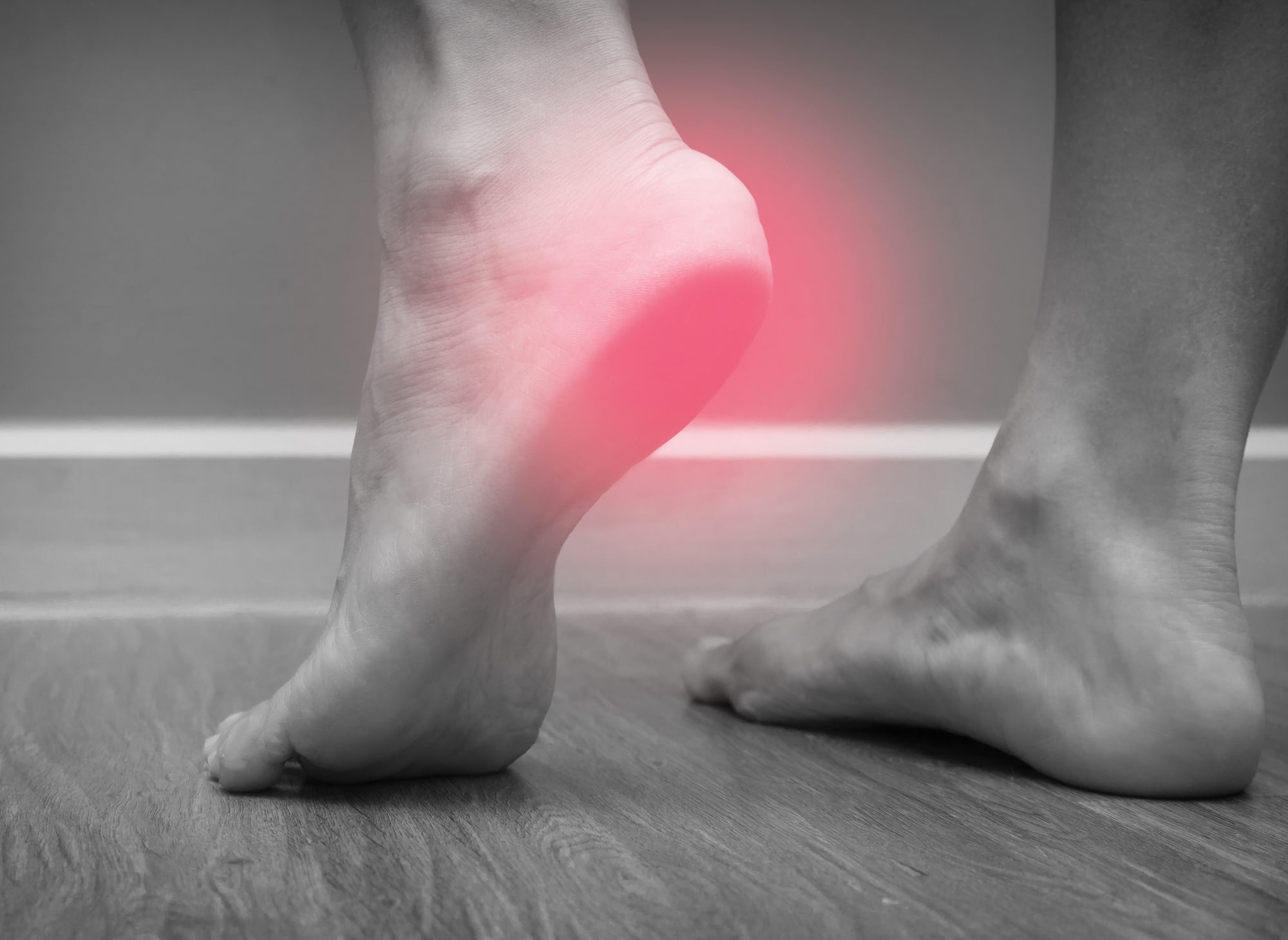 Fascite plantare: sintomi, esercizi e trattamenti